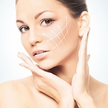 Fios de Sustentação Facial Preço