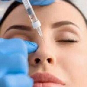 rinomodelacao 420×420